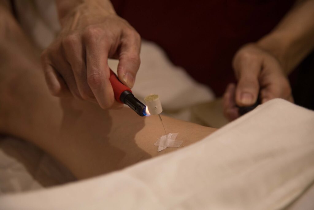 32765946_1480068445449913_3427943347468107776_n